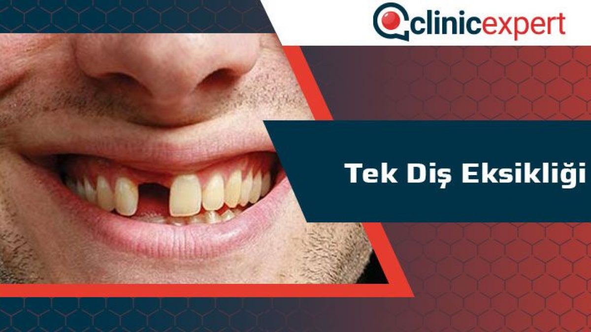 tek dis eksikligi clinicexpert uluslararasi saglik hizmetleri