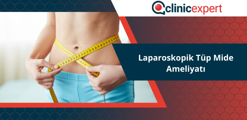 Laparoskopik Tüp Mide Ameliyatı