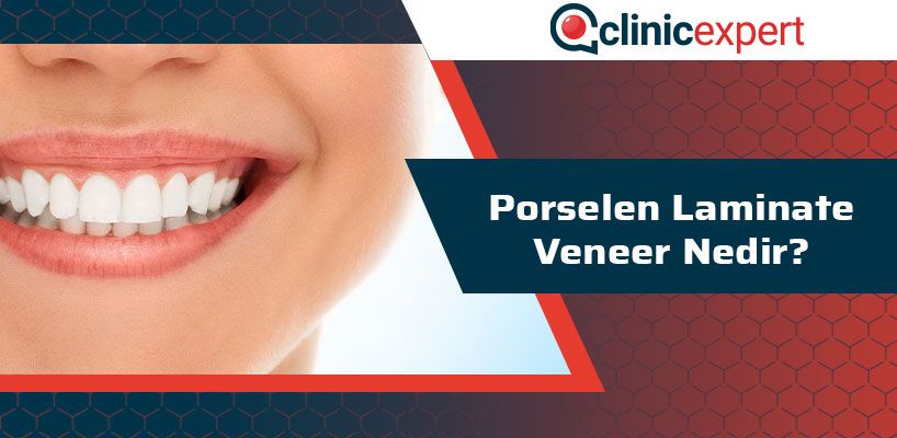 Porselen Laminate Veener Nedir?