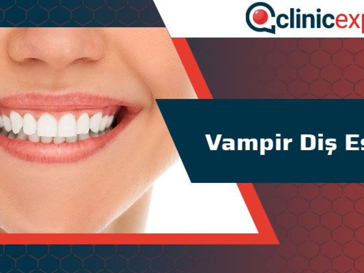 vampir dis estetigi clinicexpert uluslararasi saglik hizmetleri