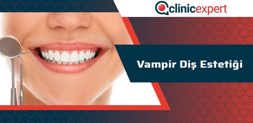 Vampir Diş Estetiği