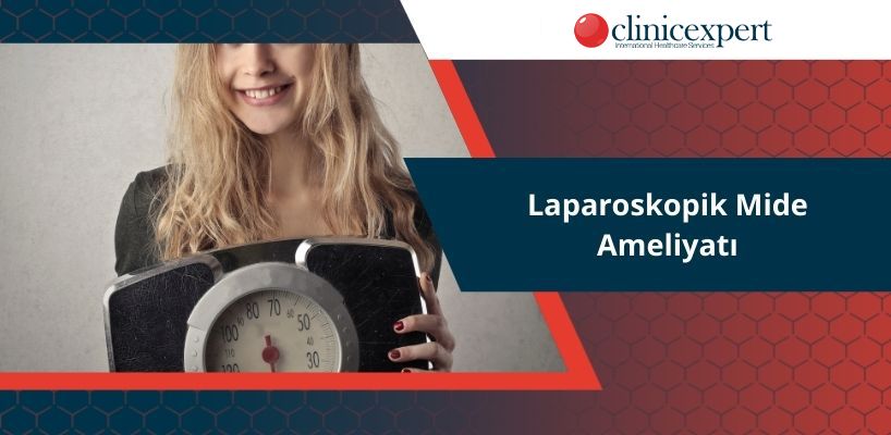 Laparoskopik Mide Ameliyatı