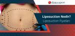 Liposuction (Liposakşın) Nedir? Liposuction Fiyatları