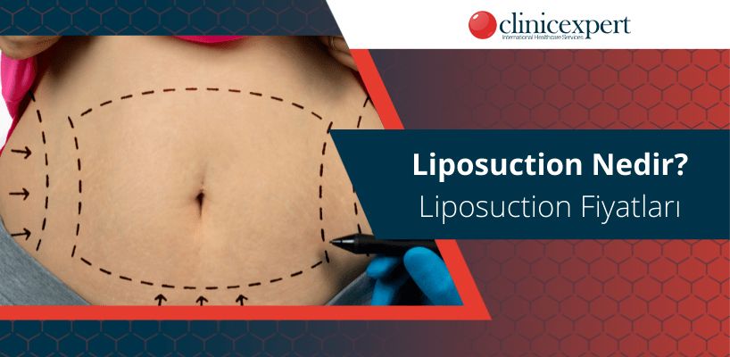 Liposuction (Liposakşın) Nedir? Liposuction Fiyatları