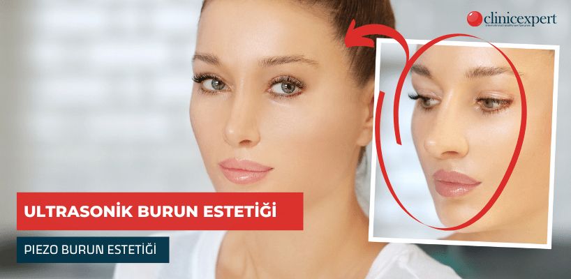 Ultrasonik Burun Estetiği Piezo Burun Estetiği