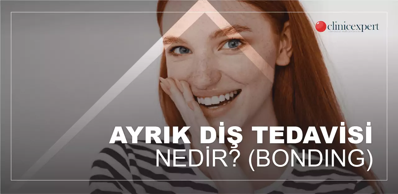 ayrik-dis-tedavisi-bonding