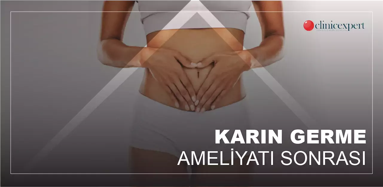 karın-germe-ameliyatı-sonrası