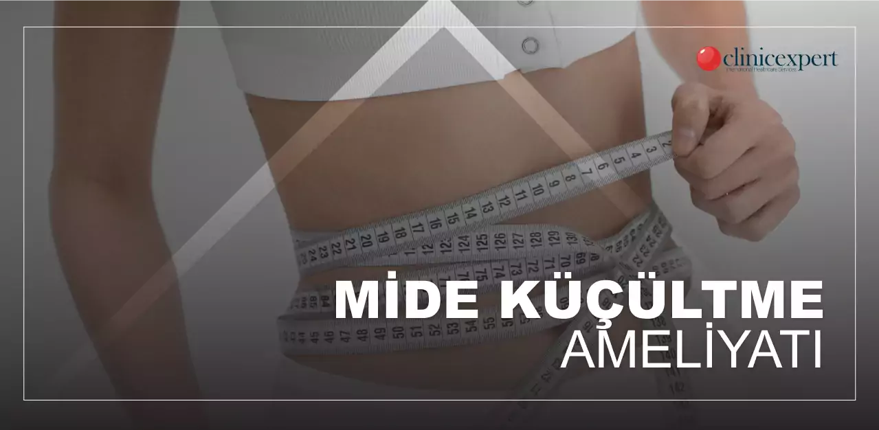 mide-küçültme-ameliyatı-fiyatı