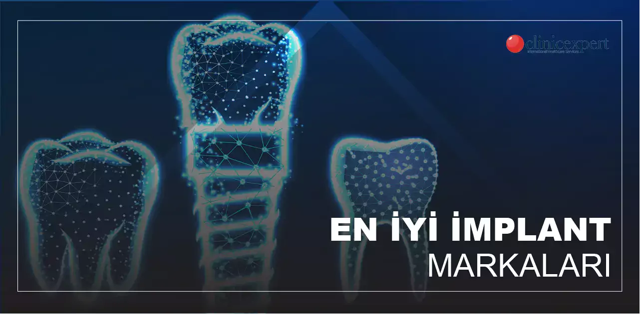 implant markaları