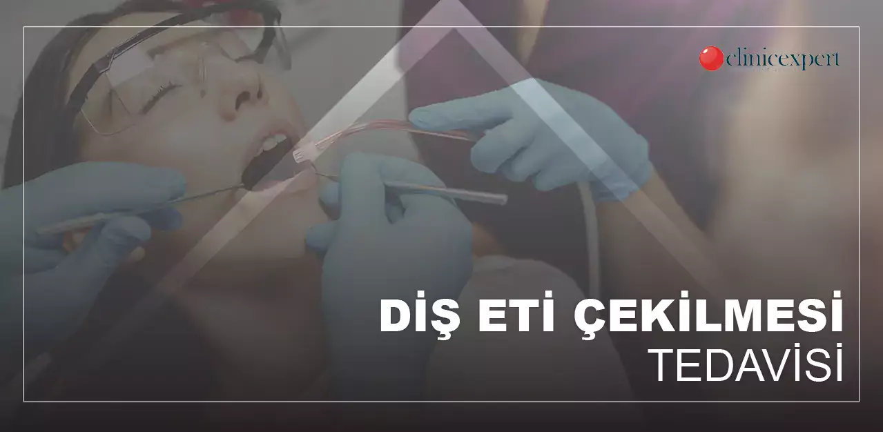 diş-eti-çekilmesi-ameliyatı-tedavi-yöntemleri