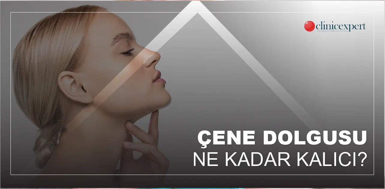 Çene Dolgusu Ne Kadar Kalıcı?